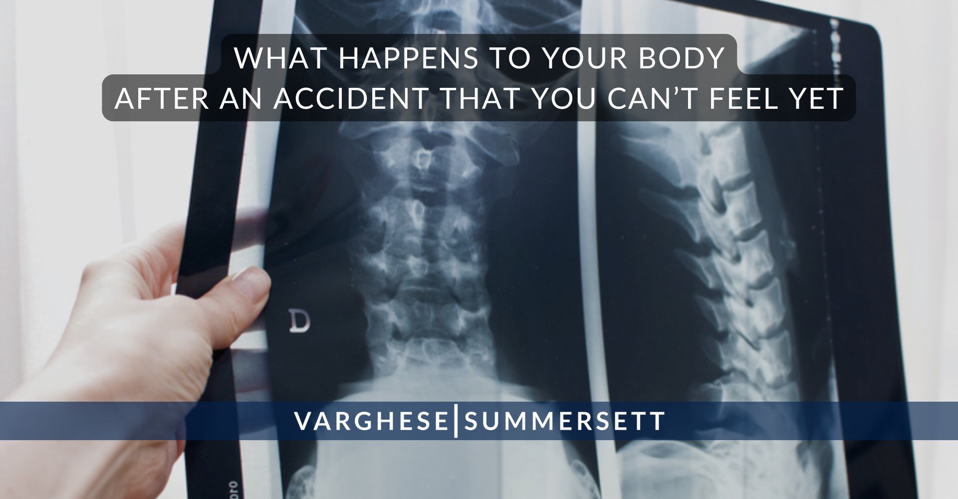 What Happens to Your Body After an Accident That You Can’t Feel Yet