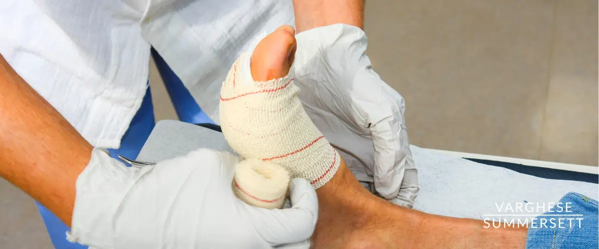 Foot injury from car accident