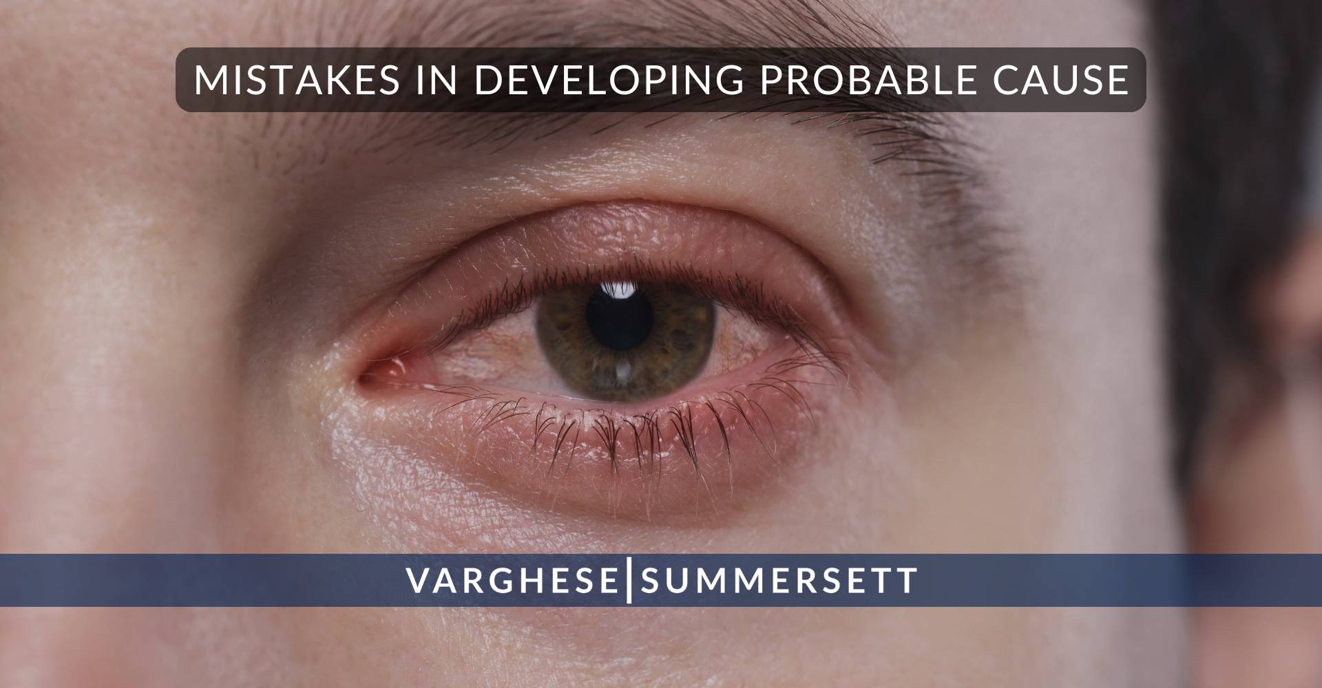 Errores en el desarrollo de la causa probable