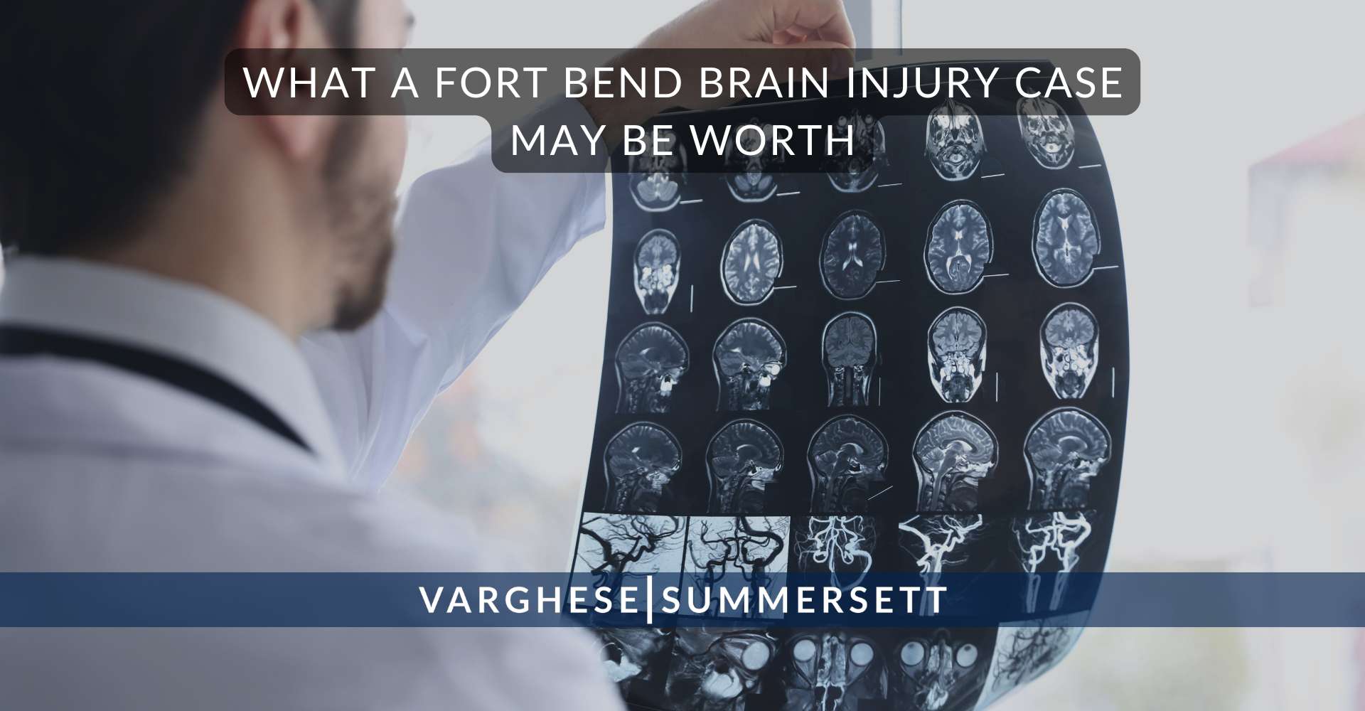 Cuánto puede valer un caso de lesión cerebral en Fort Bend